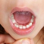 Tandkött (gums): Look beyond the tongue and what can you see - 'teeth meat' of course.Photo: <a href="http://shutr.bz/1sIk3TM"> Teeth meat. Photo: Shutterstock</a>